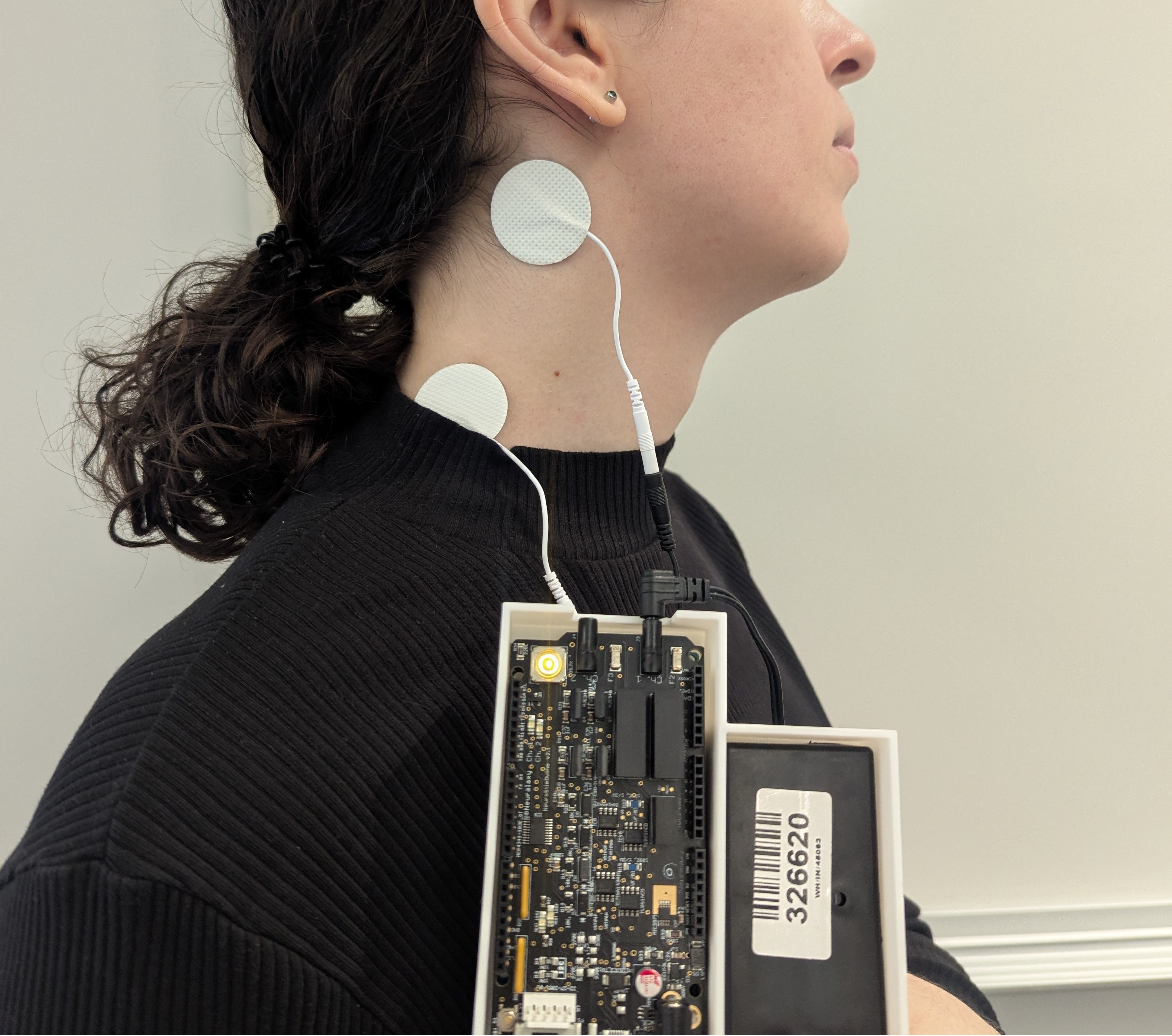 Transcutaneous Vagus Nerve Stimulation for Modulating Satiety