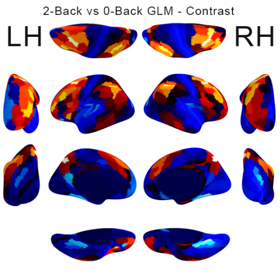 Localization of Working Memory using tfMRI